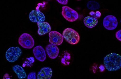 瑞士生物科技公司invasight利用突破性的細(xì)胞間蛋白靶點(diǎn)發(fā)現(xiàn)平臺(tái),開發(fā)蛋白質(zhì) 蛋白質(zhì)相互作用抑制劑,靶向治療侵襲性癌癥 瑞士創(chuàng)新100強(qiáng)